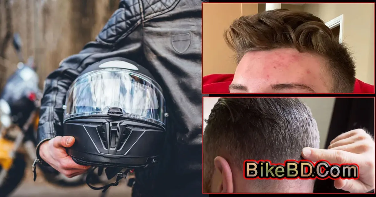 How To Prevent Helmet 